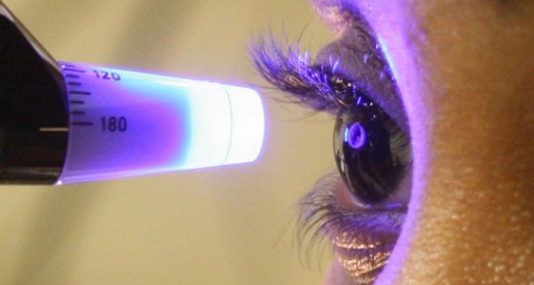 Glaucoma Screening